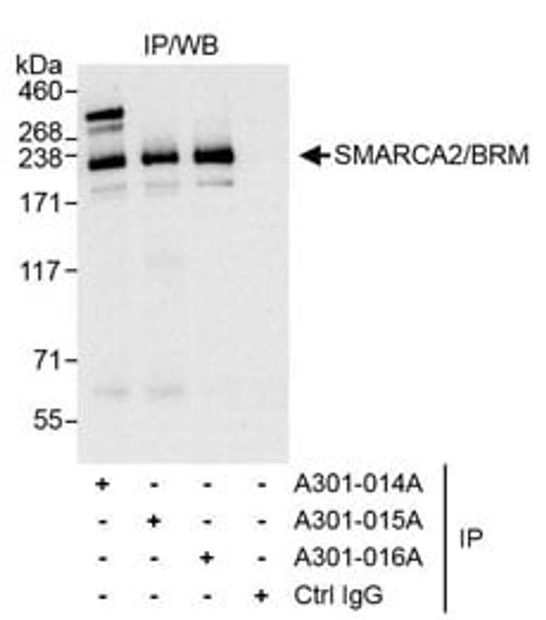 Detection of human SMARCA2/BRM by western blot of immunoprecipitates.