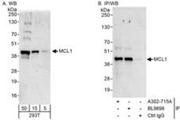 Detection of human MCL1 by western blot and immunoprecipitation.