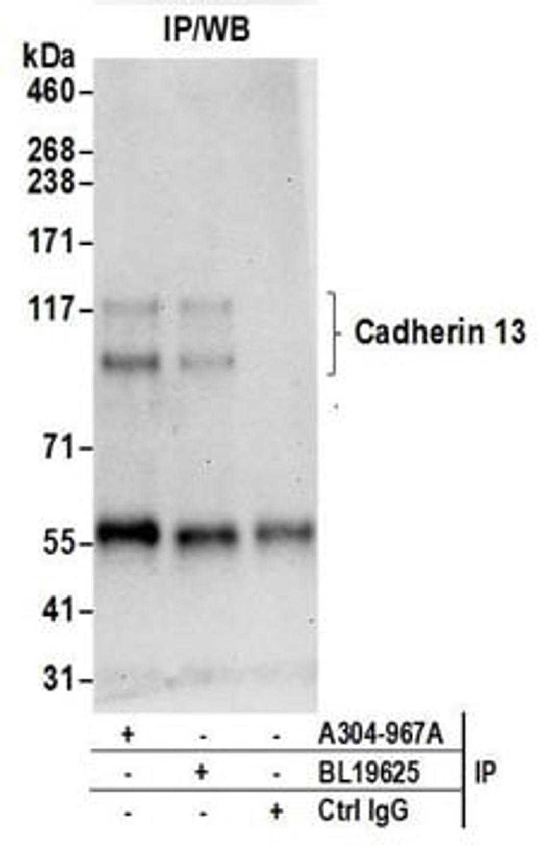 Detection of human Cadherin 13 by western blot of immunoprecipitates.