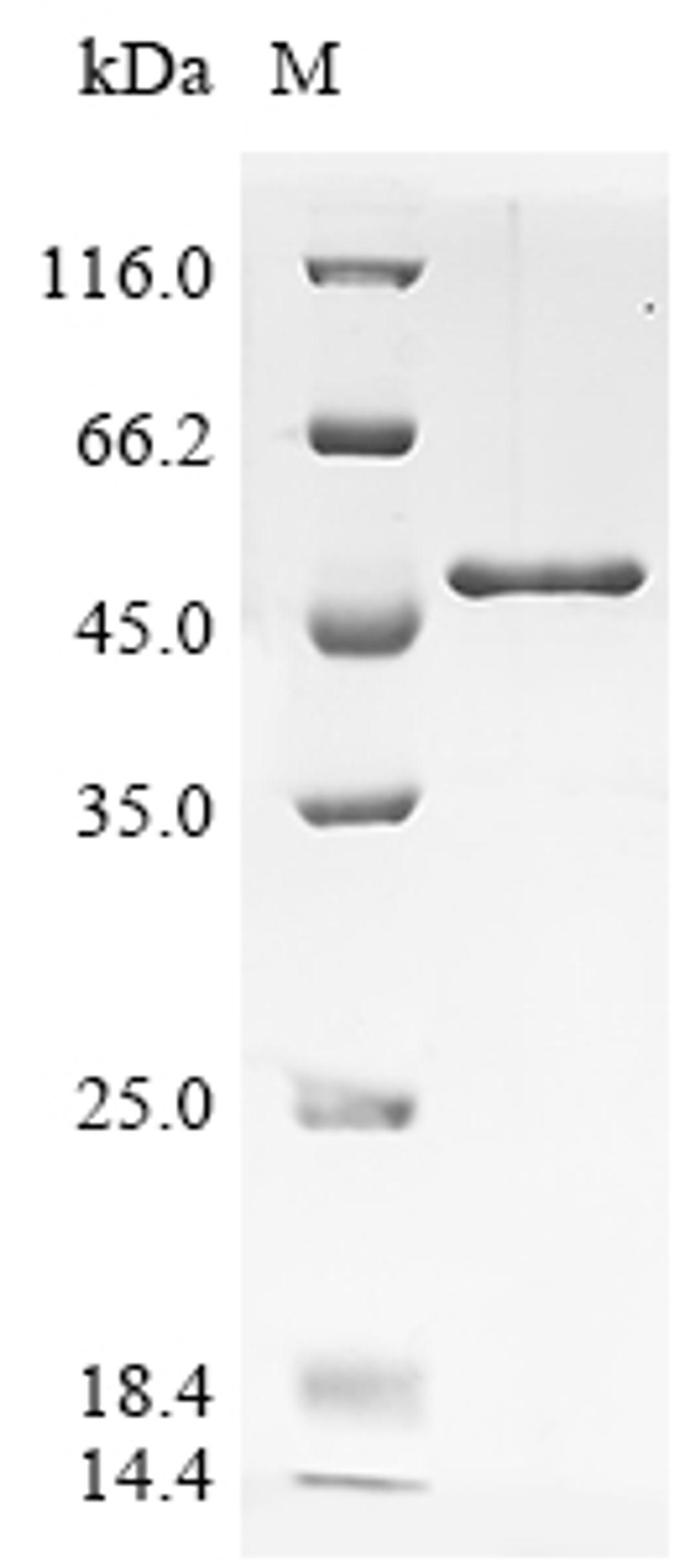 (Tris-Glycine gel) Discontinuous SDS-PAGE (reduced) with 5% enrichment gel and 15% separation gel.