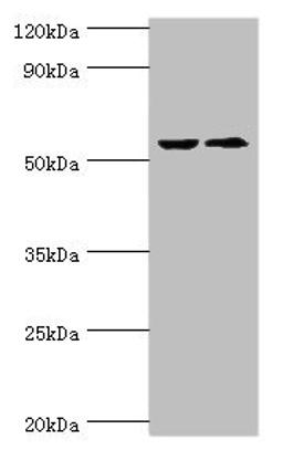 Western blot. All lanes: CASP8 antibody at 2µg/ml. Lane 1: ACCM whole cell lysate. Lane 2: LO2 whole cell lysate. Secondary. Goat polyclonal to rabbit IgG at 1/10000 dilution. Predicted band size: 56, 54, 46, 58, 28, 26, 33, 31, 62 kDa. Observed band size: 56 kDa