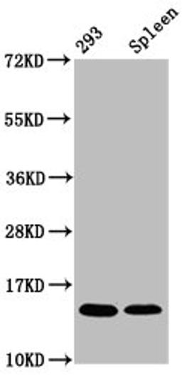 Western Blot. Positive WB detected in: 293 whole cell lysate, Rat spleen tissue. All lanes: HIST1H2BC antibody at 1.64µg/ml. Secondary. Goat polyclonal to rabbit IgG at 1/50000 dilution. Predicted band size: 14 kDa. Observed band size: 14 kDa