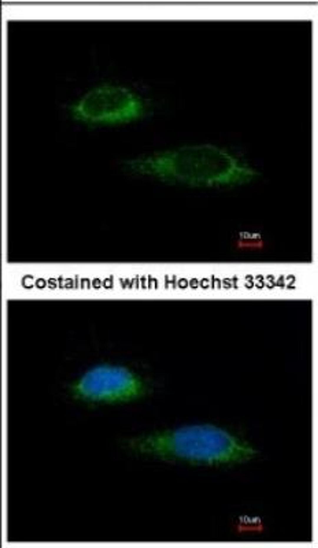 Immunocytochemistry/Immunofluorescence: Glutamate Dehydrogenase Antibody [NBP2-16679] - Immunofluorescence analysis of methanol-fixed HeLa, using antibody at 1:100 dilution.