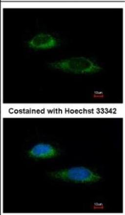 Immunocytochemistry/Immunofluorescence: Glutamate Dehydrogenase Antibody [NBP2-16679] - Immunofluorescence analysis of methanol-fixed HeLa, using antibody at 1:100 dilution.