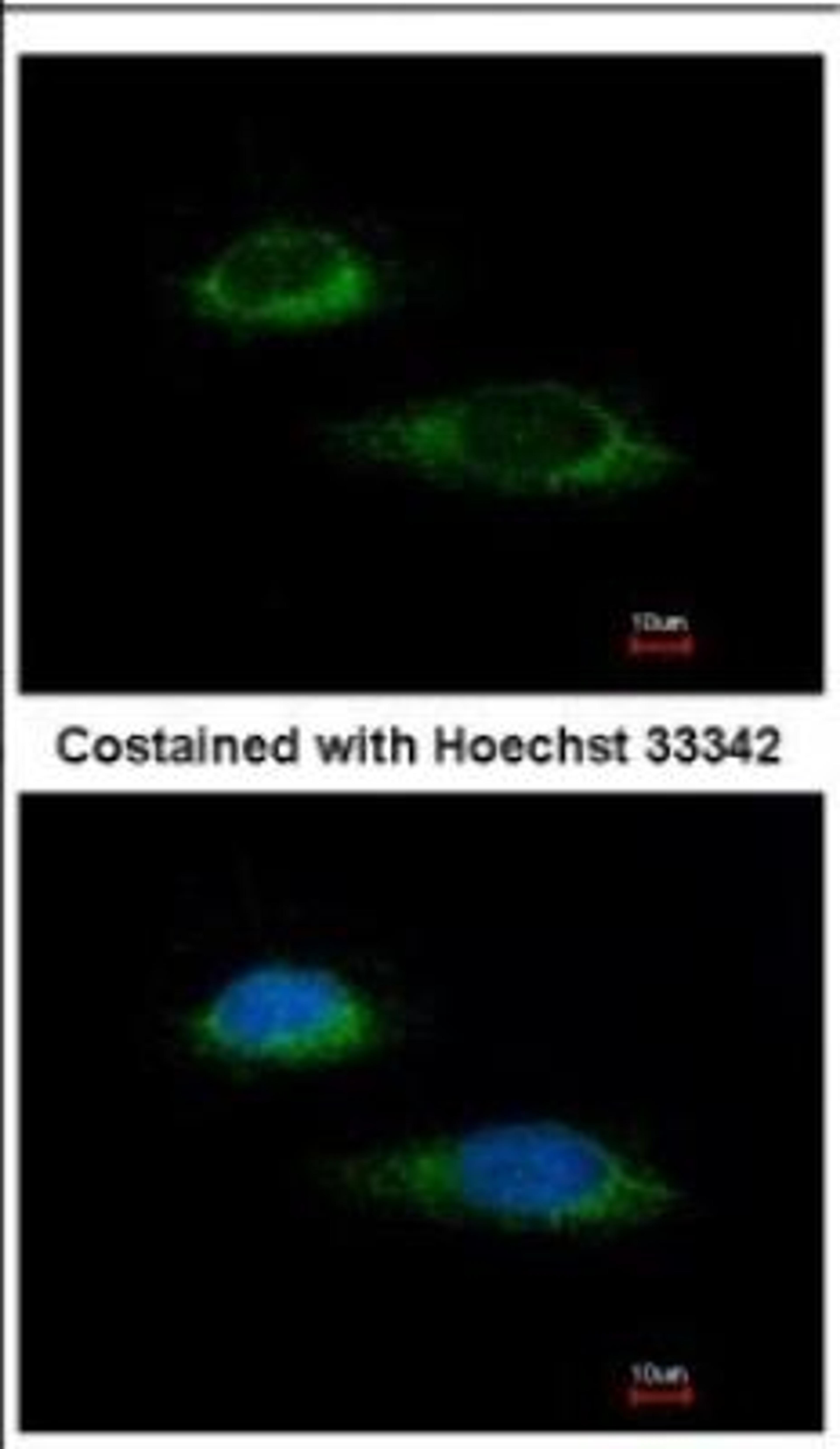 Immunocytochemistry/Immunofluorescence: Glutamate Dehydrogenase Antibody [NBP2-16679] - Immunofluorescence analysis of methanol-fixed HeLa, using antibody at 1:100 dilution.