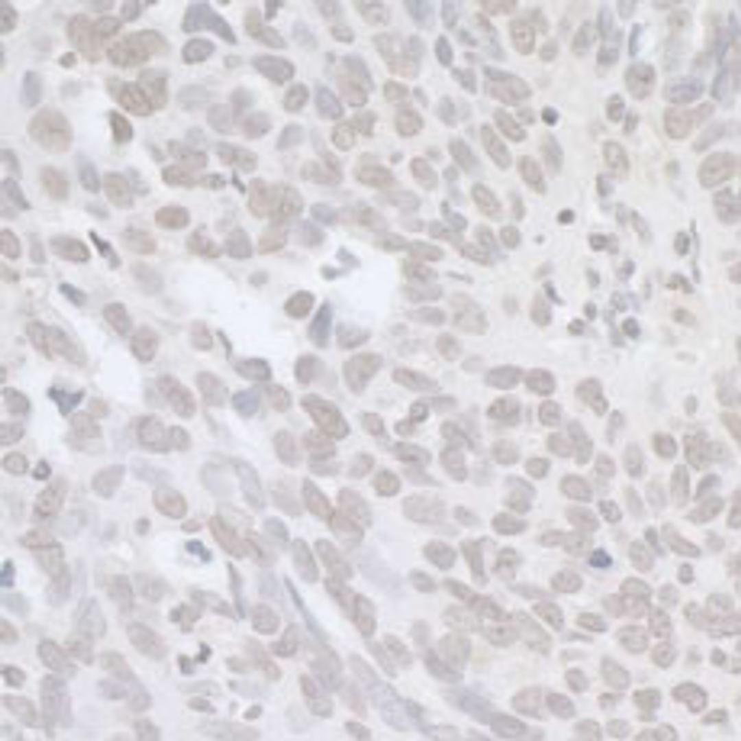 Detection of human BRCA1 by immunohistochemistry.