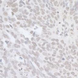 Detection of human BRCA1 by immunohistochemistry.