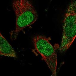 Immunofluorescence: DEF6 Antibody [NBP1-81618] - Staining of human cell line U-251 MG shows positivity in nucleus but not nucleoli.