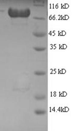 (Tris-Glycine gel) Discontinuous SDS-PAGE (reduced) with 5% enrichment gel and 15% separation gel.