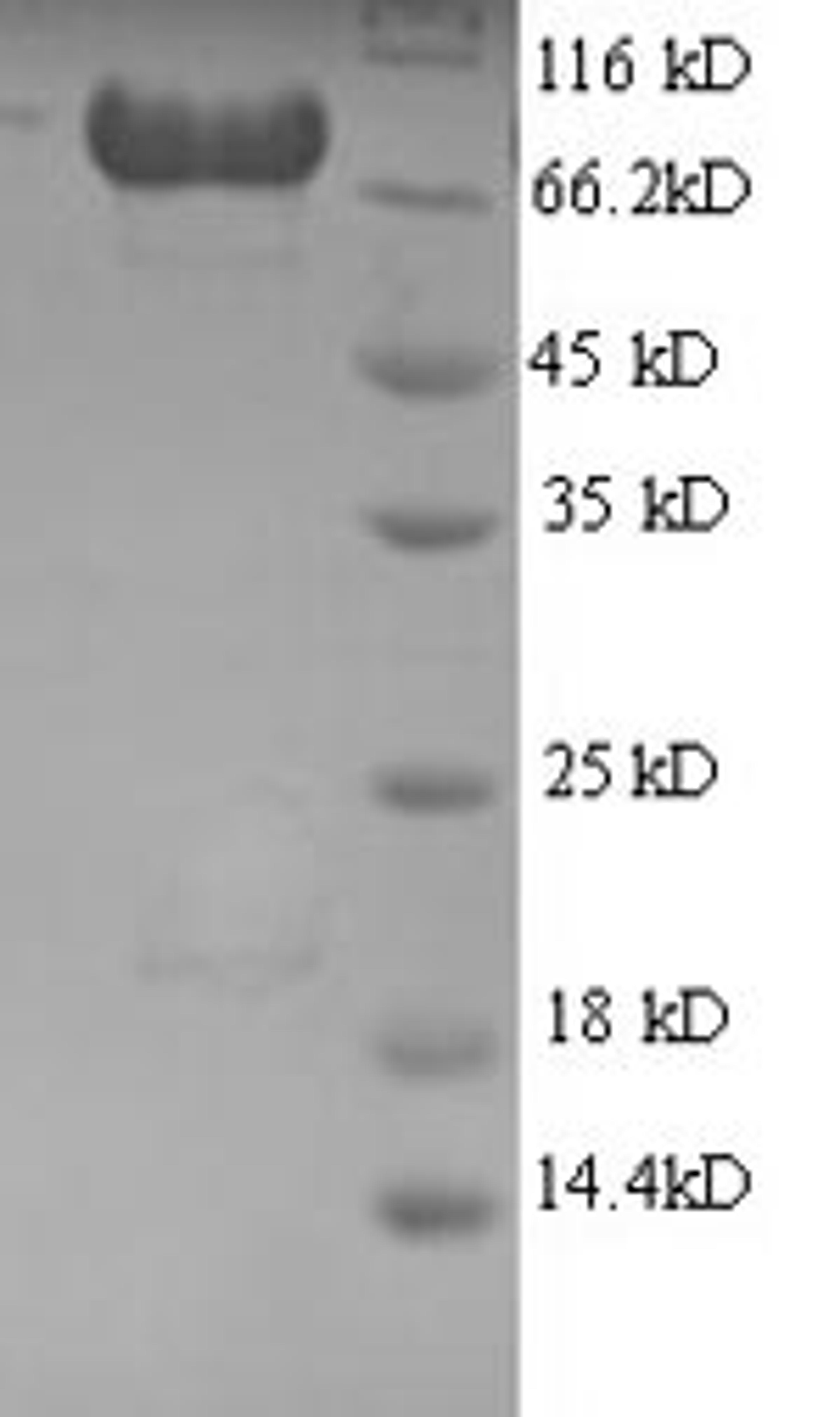 (Tris-Glycine gel) Discontinuous SDS-PAGE (reduced) with 5% enrichment gel and 15% separation gel.
