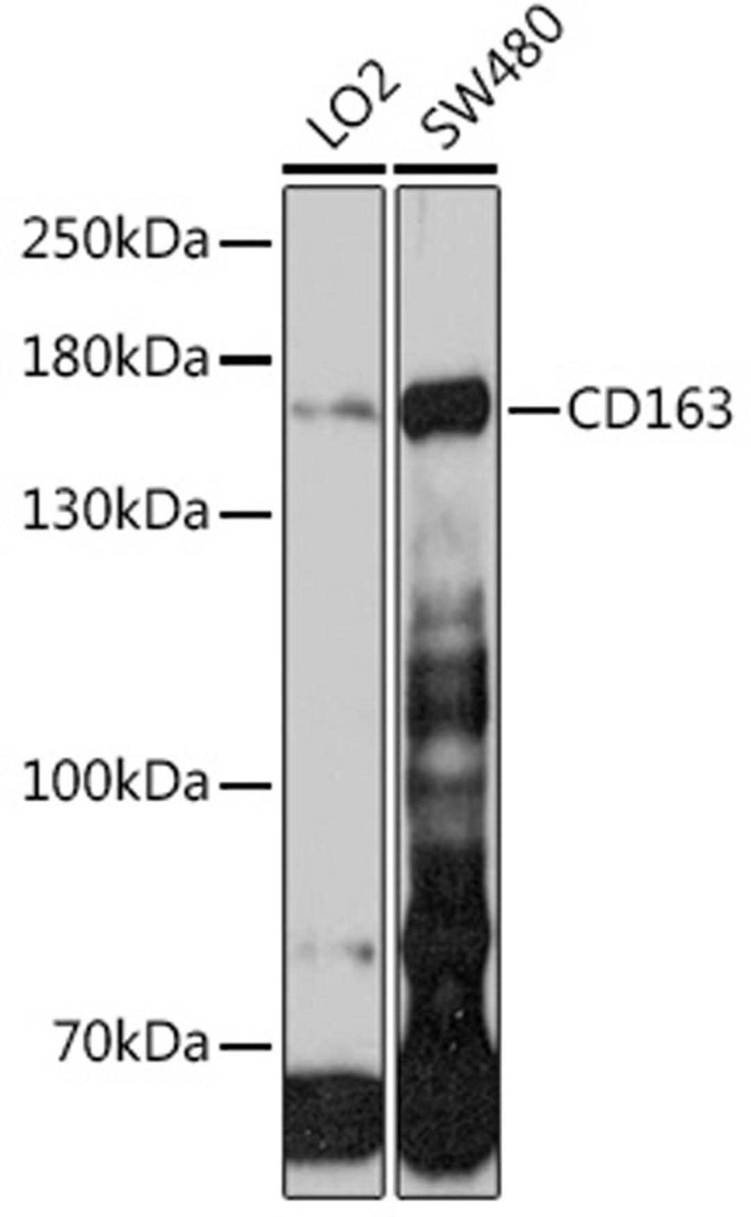 Western blot - CD163 antibody (A8383)