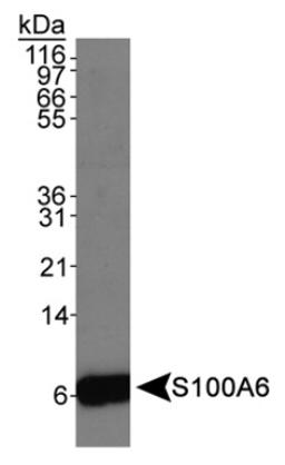 Western Blot: S100A6 Antibody [NB110-93274] - Detection of S100A6 antibody in Hela whole cell extracts using NB110-93274.