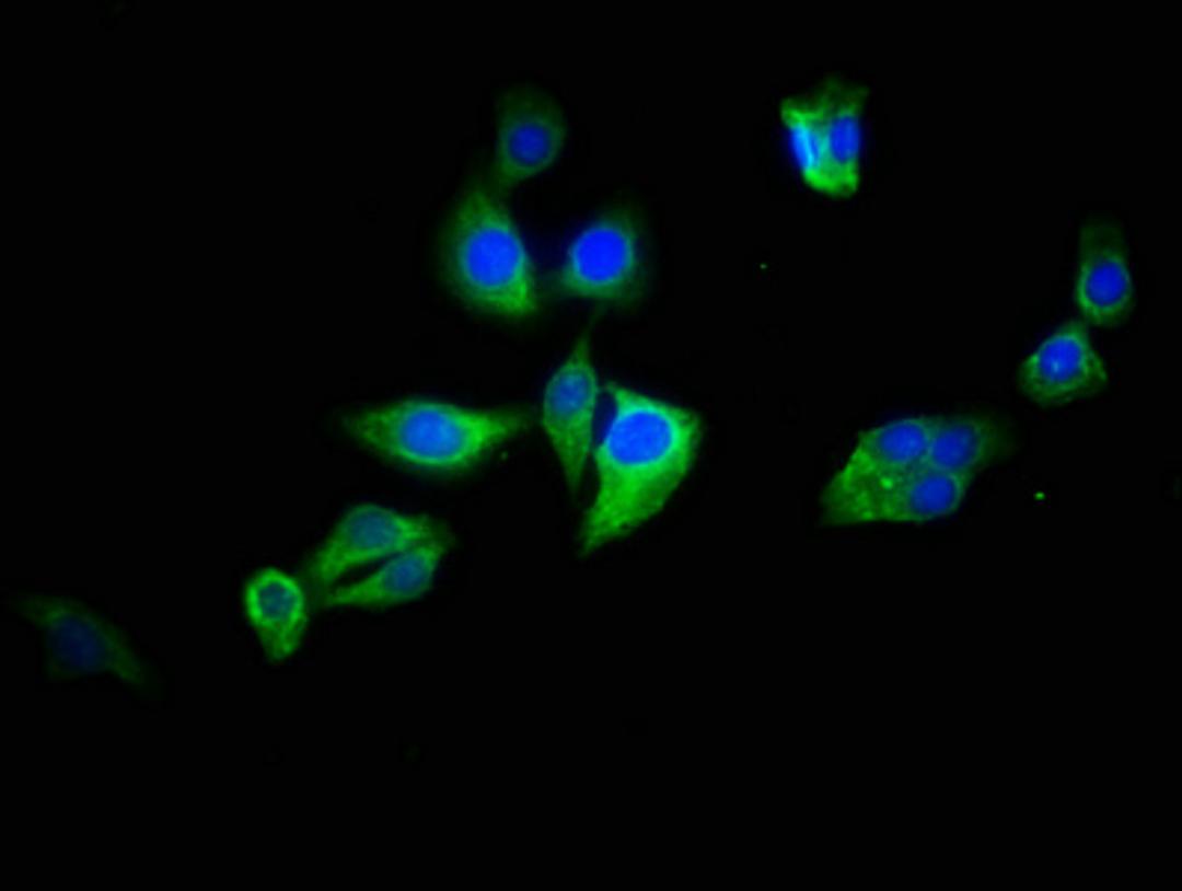 Immunofluorescence staining of HepG2 cells with CSB-PA822186LA01HU at 1:133, counter-stained with DAPI. The cells were fixed in 4% formaldehyde, permeabilized using 0.2% Triton X-100 and blocked in 10% normal Goat Serum. The cells were then incubated with the antibody overnight at 4°C. The secondary antibody was Alexa Fluor 488-congugated AffiniPure Goat Anti-Rabbit IgG(H+L).