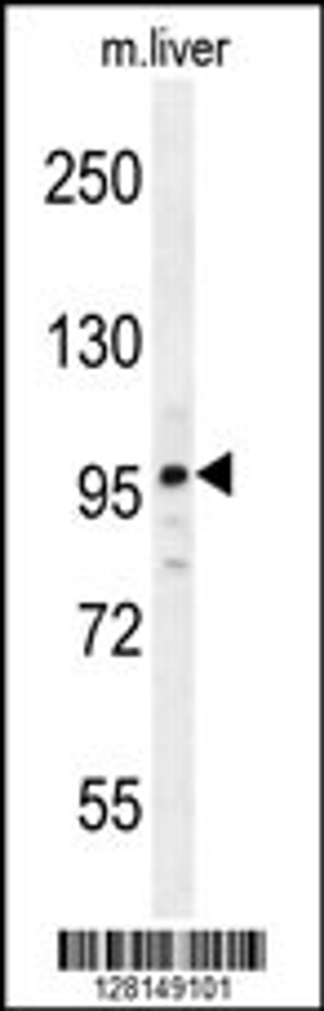 Western blot analysis in mouse liver tissue lysates (35ug/lane).