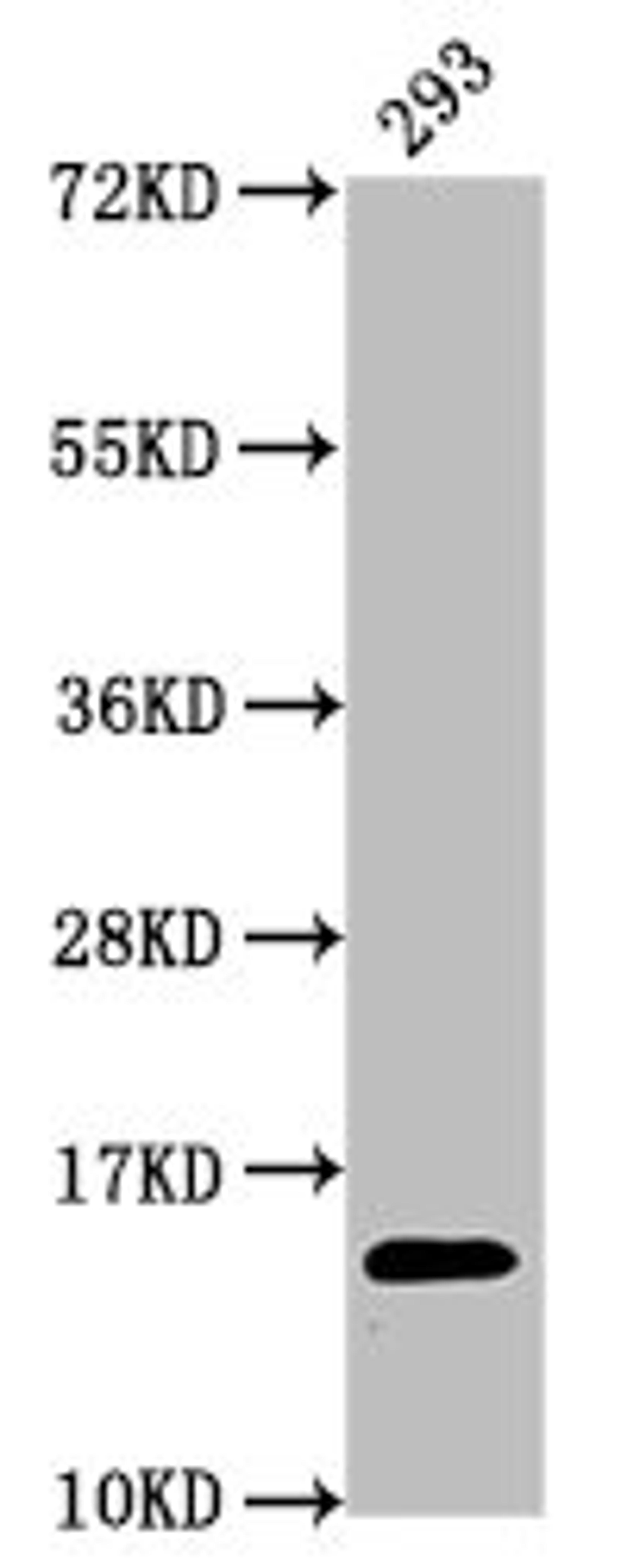 Western Blot. Positive WB detected in: 293 whole cell lysate. All lanes: HIST1H2AG antibody at 0.74µg/ml. Secondary. Goat polyclonal to rabbit IgG at 1/50000 dilution. Predicted band size: 15 kDa. Observed band size: 15 kDa