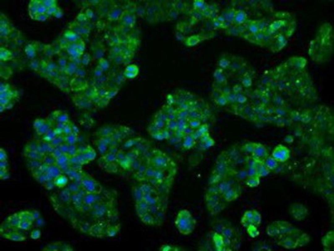 Immunocytochemistry/Immunofluorescence: Cytochrome P450 2E1 Antibody (5B9) [NBP2-02155] - Immunofluorescent staining of HepG2 cells using anti-Cytochrome P450 2E1mouse monoclonal antibody.