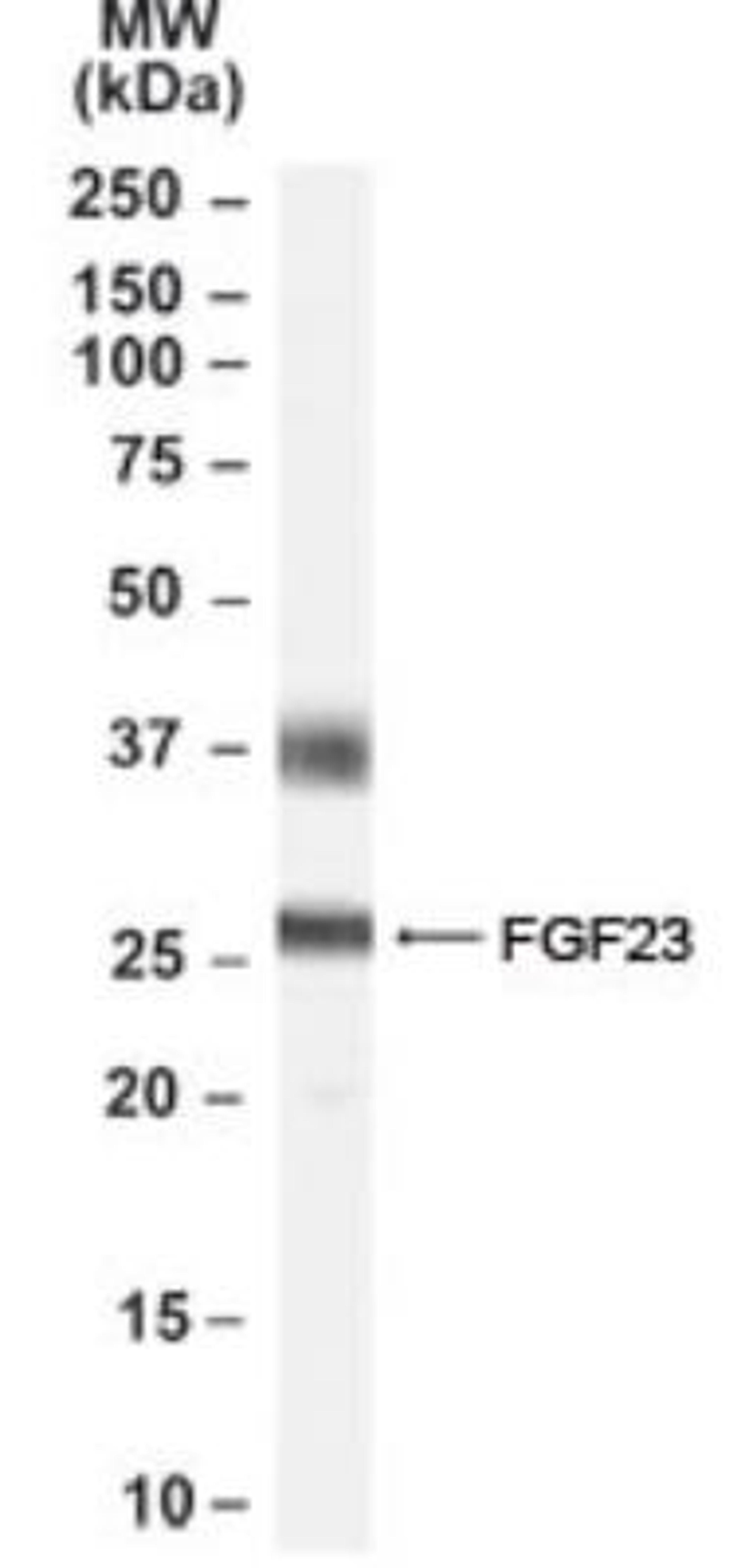 Western Blot: FGF-23 Antibody [NB100-55423] - Human brain (Hippocampus) lysate using this antibody at 0.5 ug/ml