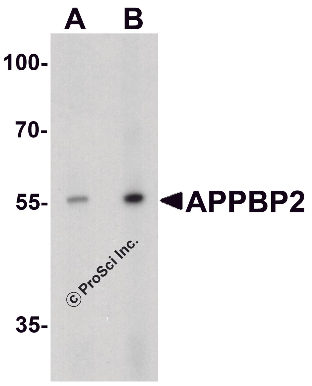 Western blot analysis of APPBP2 in human brain tissue lysate with APPBP2 antibody at (A) 0.5 and (B) 1 &#956;g/ml.