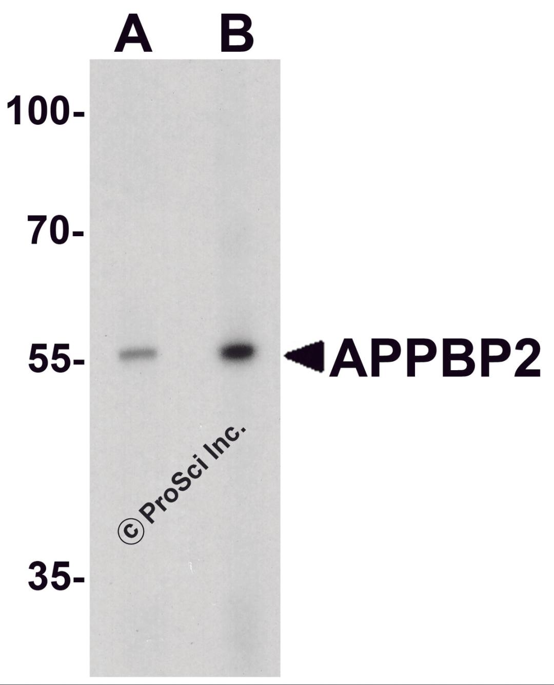 Western blot analysis of APPBP2 in human brain tissue lysate with APPBP2 antibody at (A) 0.5 and (B) 1 μg/ml.