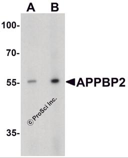 Western blot analysis of APPBP2 in human brain tissue lysate with APPBP2 antibody at (A) 0.5 and (B) 1 μg/ml.