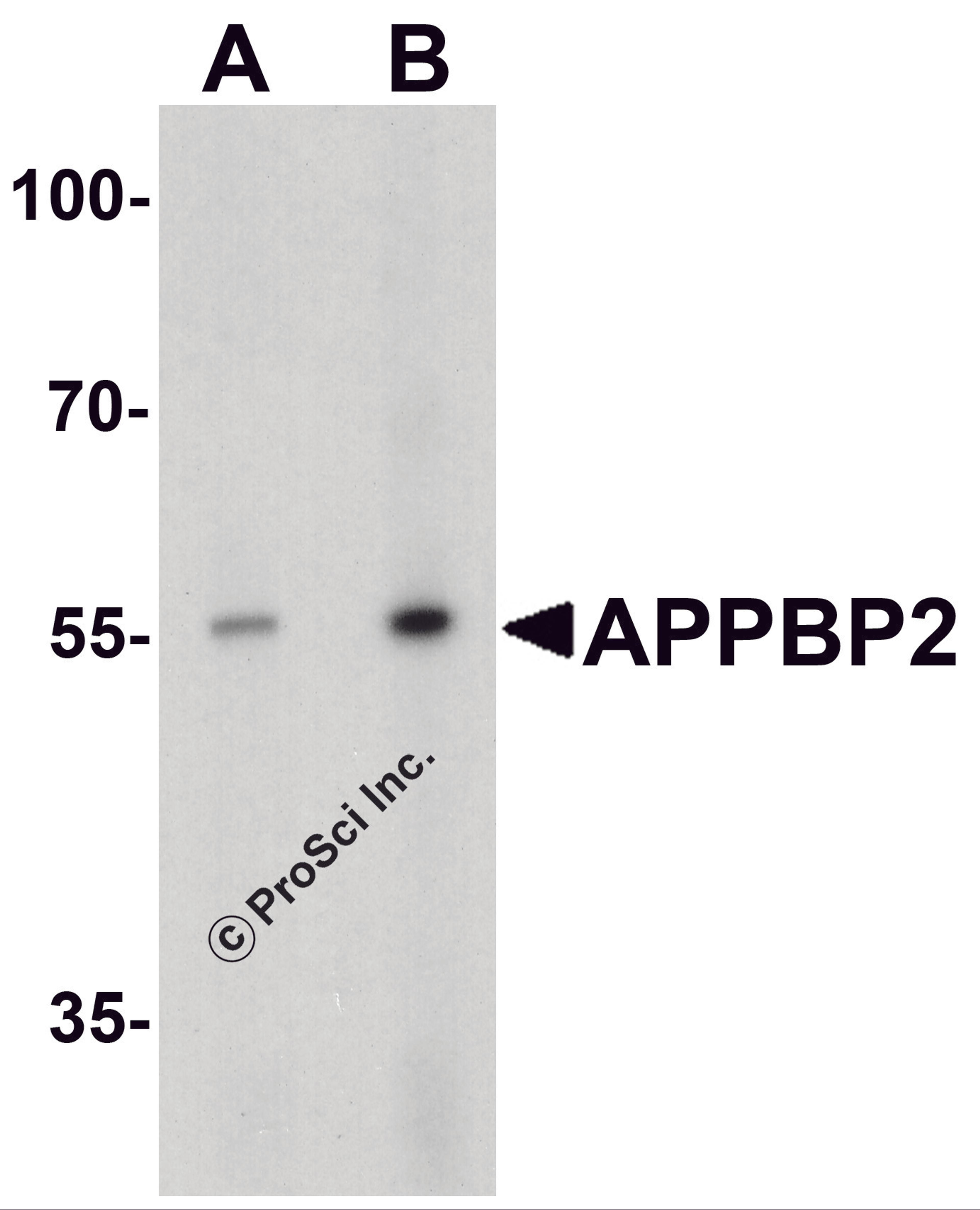 Western blot analysis of APPBP2 in human brain tissue lysate with APPBP2 antibody at (A) 0.5 and (B) 1 μg/ml.