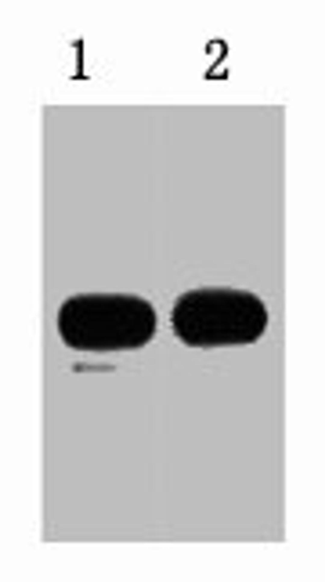 1ug KT3 fusion protein+ Primary antibody dilution at  1) 1:5000 2) 1:10000