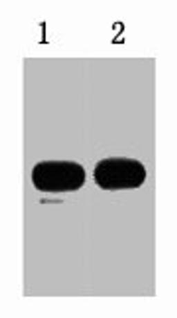 1ug KT3 fusion protein+ Primary antibody dilution at  1) 1:5000 2) 1:10000