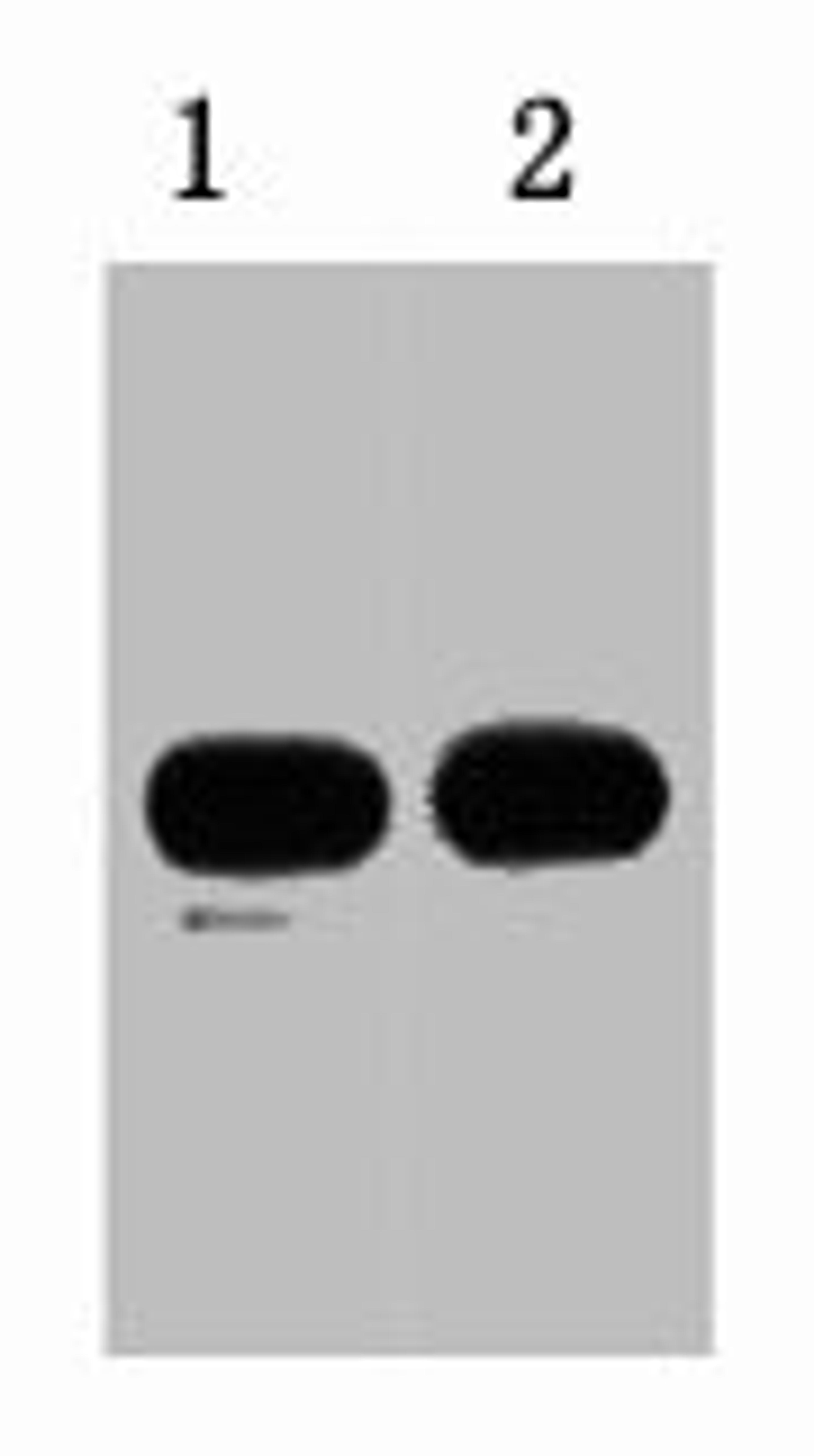 1ug KT3 fusion protein+ Primary antibody dilution at  1) 1:5000 2) 1:10000