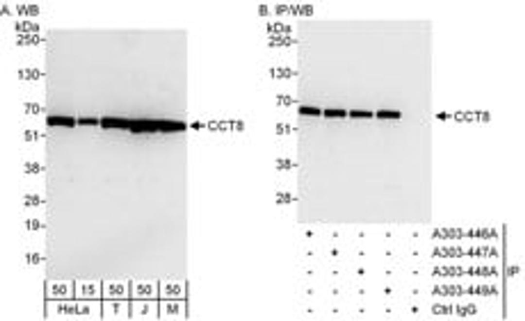 Detection of human and mouse CCT8 by western blot (h and m) and immunoprecipitation (h).