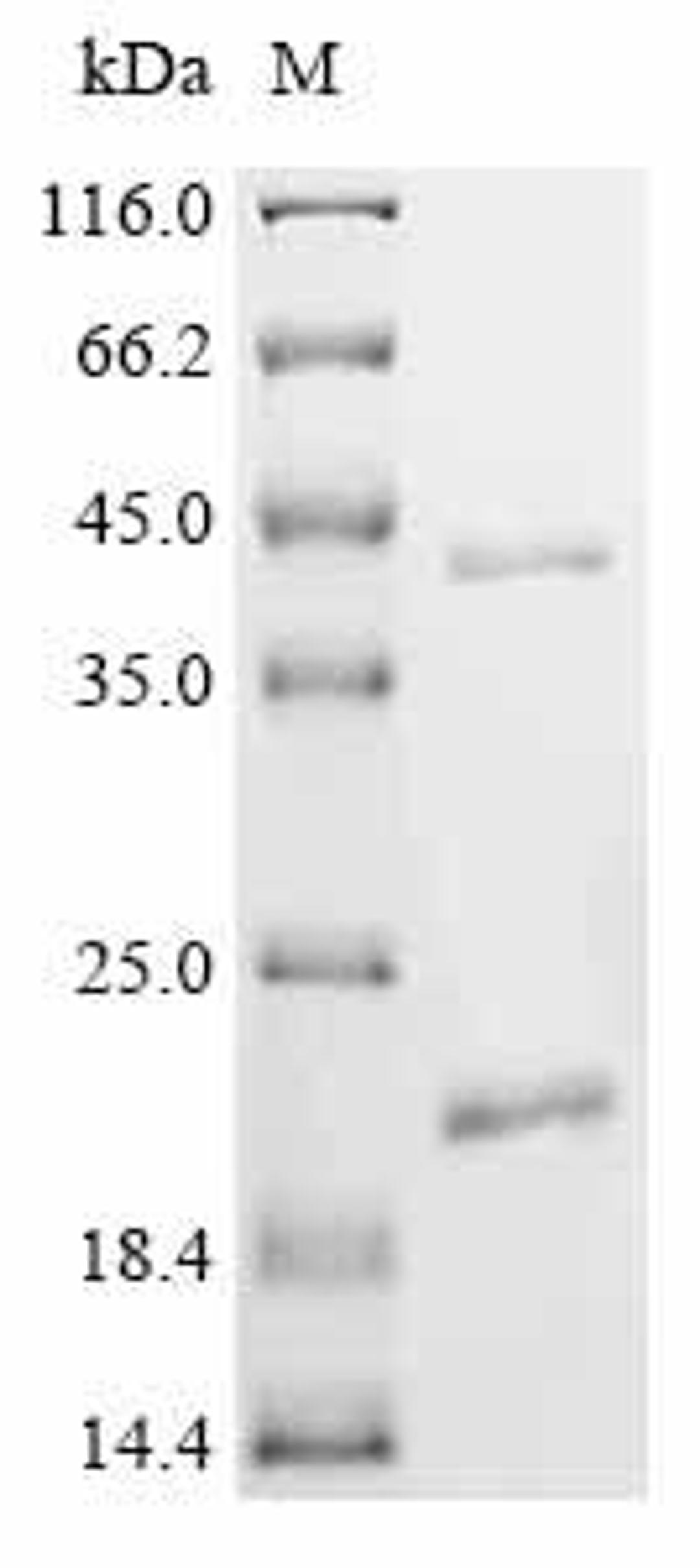 (Tris-Glycine gel) Discontinuous SDS-PAGE (reduced) with 5% enrichment gel and 15% separation gel.