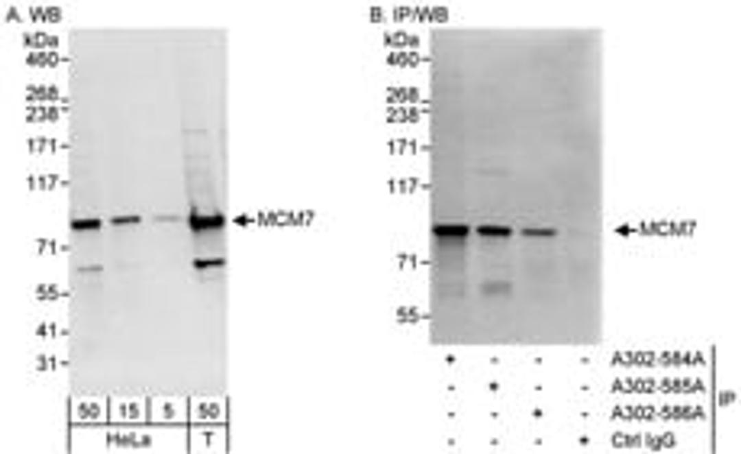 Detection of human MCM7 by western blot and immunoprecipitation.