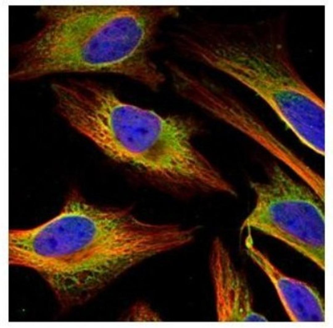 Immunocytochemistry/Immunofluorescence: FACL4 Antibody [NBP2-16401] - Confocal immunofluorescence analysis of methanol-fixed HeLa, using FACL4 antibody (Green) at 1:500 dilution. Alpha-tubulin filaments are labeled with Alpha-tubulin antibody (Red) at 1:2000.