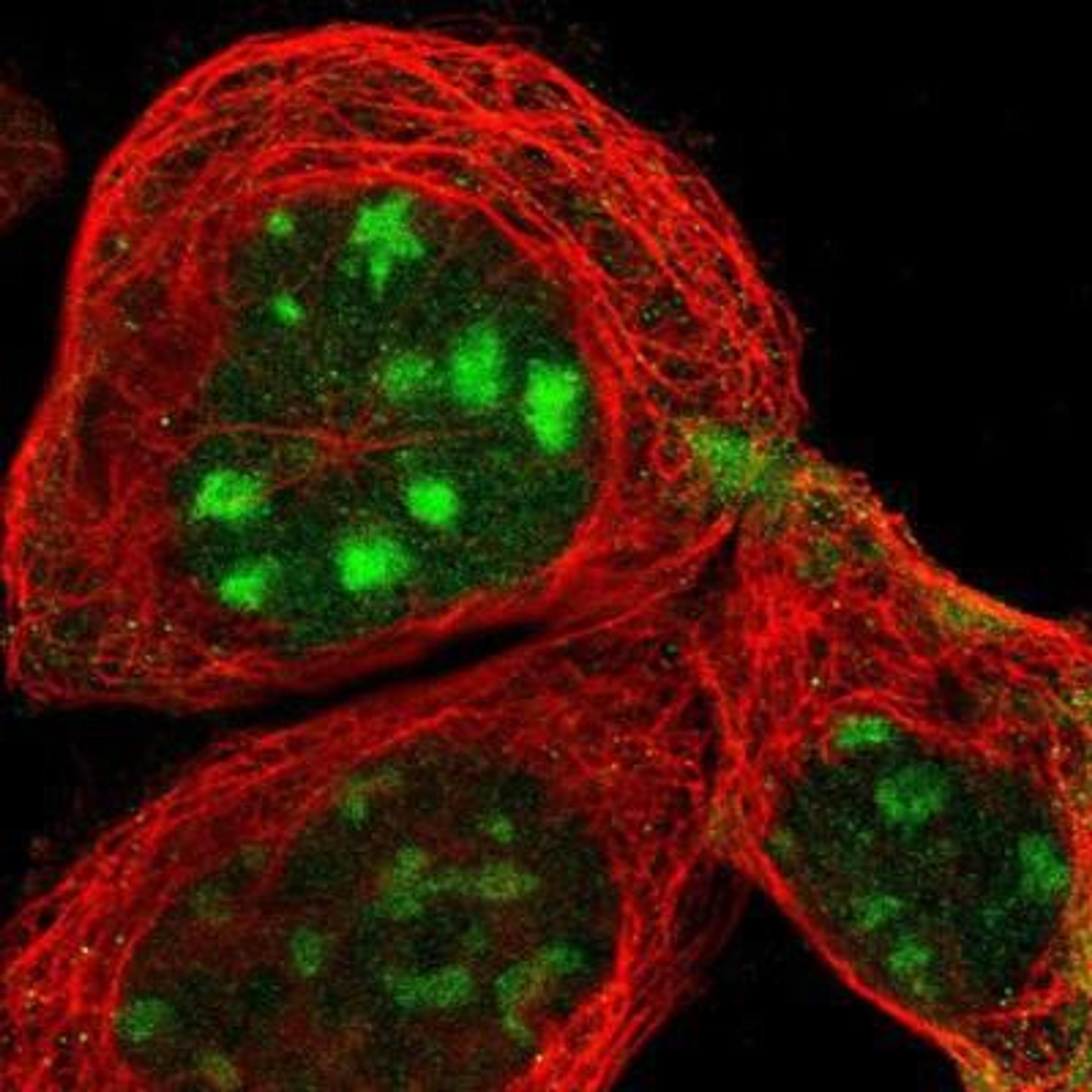 Immunocytochemistry/Immunofluorescence: PITX1 Antibody [NBP1-88644] - Staining of human cell line A-431 shows positivity in nucleoli.