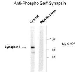Western blot of rat cortex lysate showing phosphospecific immunolabeling of the ~78k Synapsin I protein.
