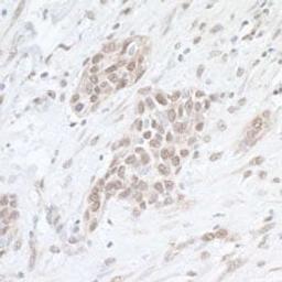 Detection of human SAE1 by immunohistochemistry.