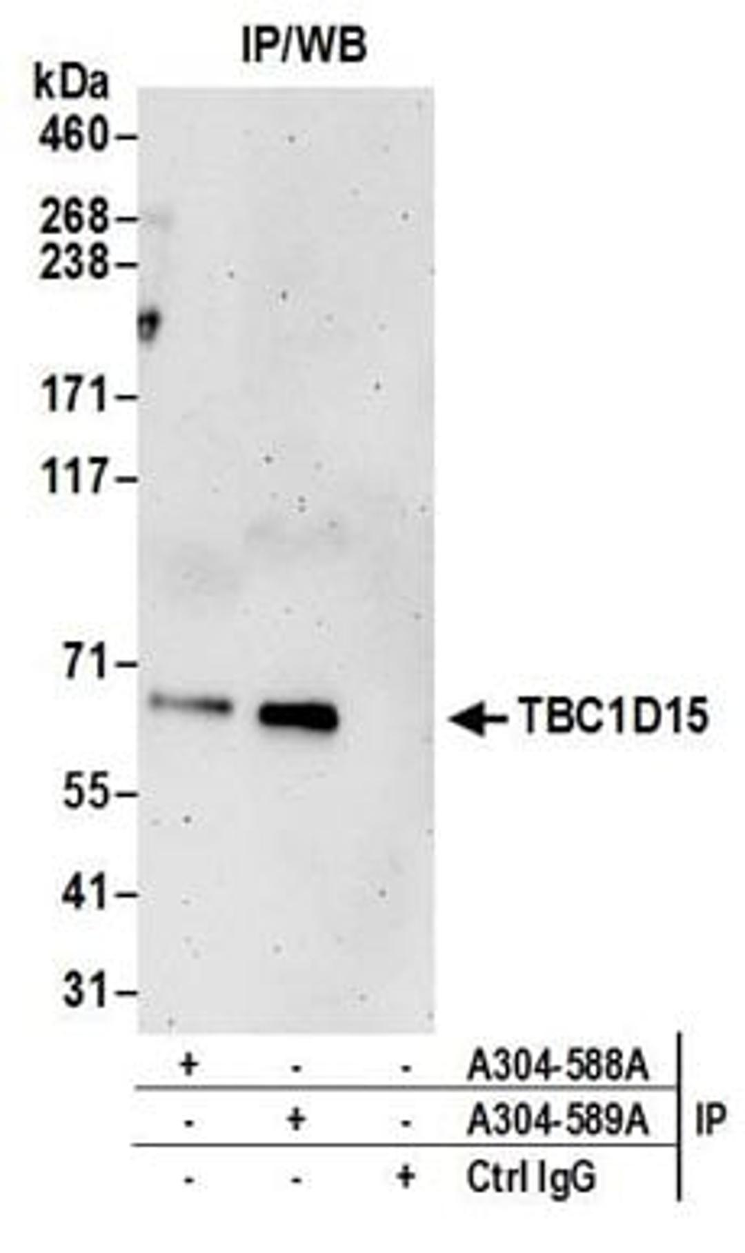 Detection of human TBC1D15 by western blot of immunoprecipitates.