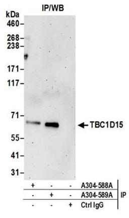 Detection of human TBC1D15 by western blot of immunoprecipitates.