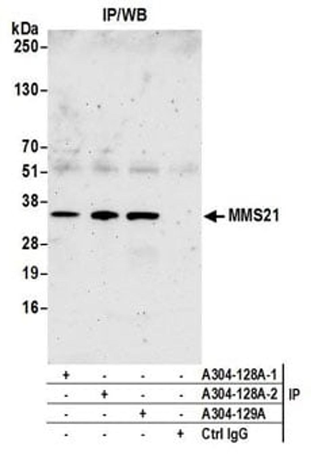 Detection of human MMS21 by western blot of immunoprecipitates.