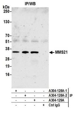 Detection of human MMS21 by western blot of immunoprecipitates.