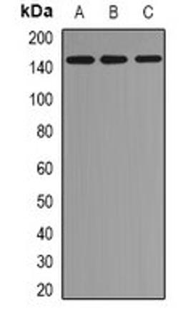 Western blot analysis of mouse brain (Lane1), mouse spleen (Lane2), mouse kidney (Lane3) whole cell lysates using EMSY antibody