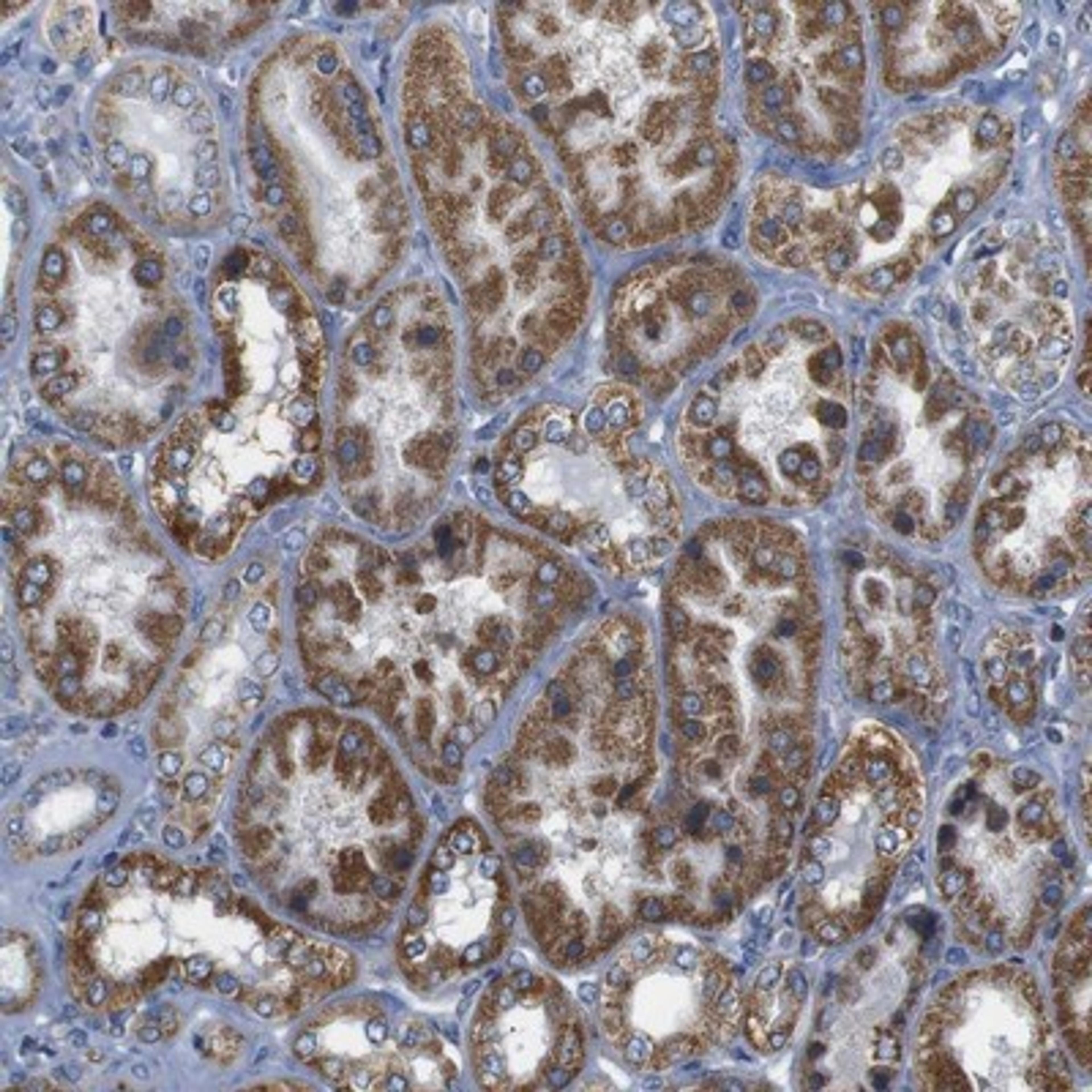 Immunohistochemistry-Paraffin: FAM171B Antibody [NBP1-93847] - Staining of human kidney shows strong cytoplasmic positivity in cells in tubules.