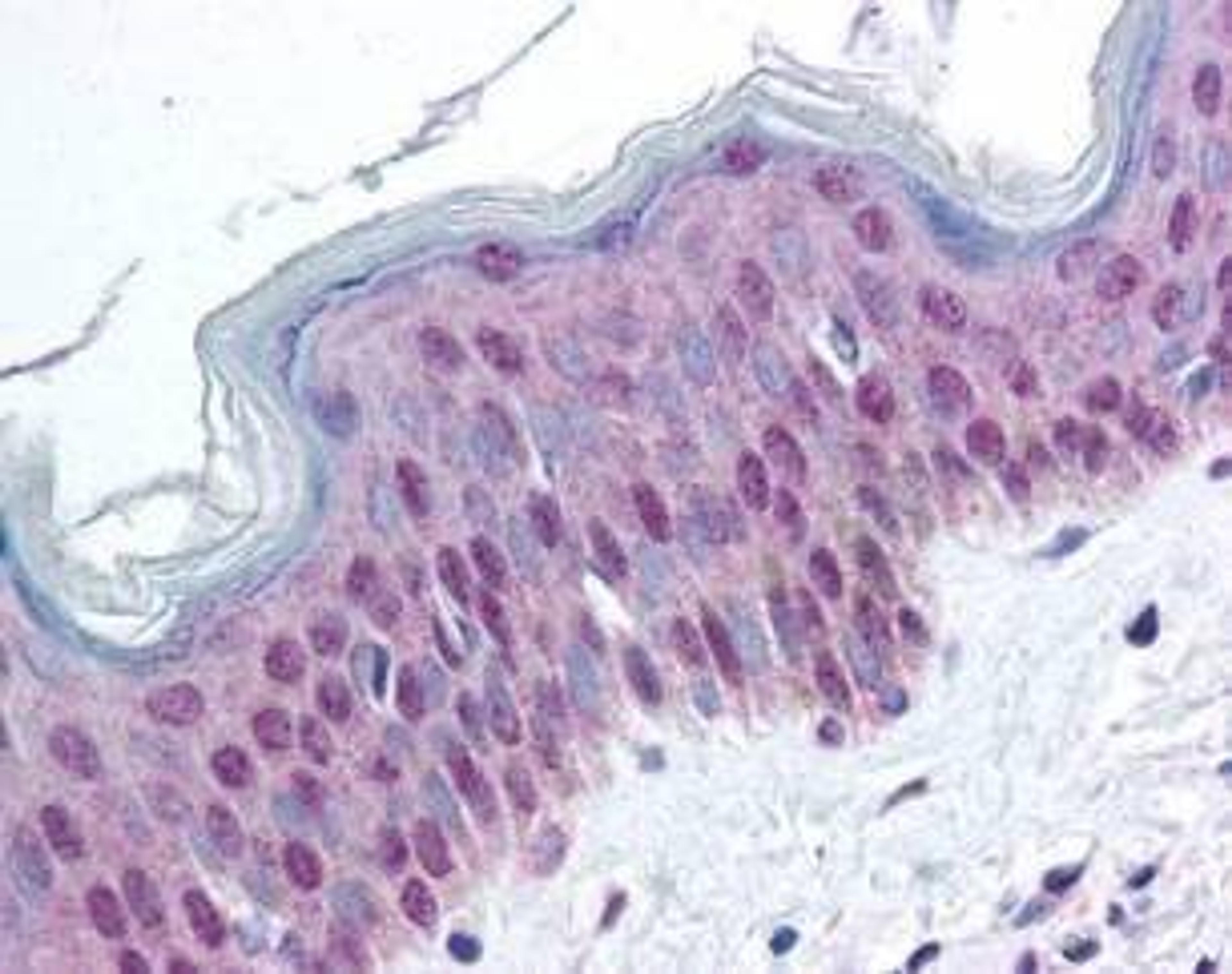 Immunohistochemical staining of multi-human, multi-brain and multi-cancer slides using HMGN (phospho-S20/S24) antibody