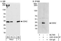 Detection of human CDK2 by western blot and immunoprecipitation.