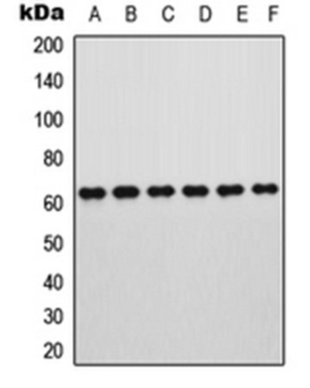 Western blot analysis of HeLa (Lane 1), HEK293T (Lane 2), HepG2 (Lane 3), U266 (Lane 4), OPM2 (Lane 5), PC12 (Lane 6) whole cell lysates using ROR alpha antibody