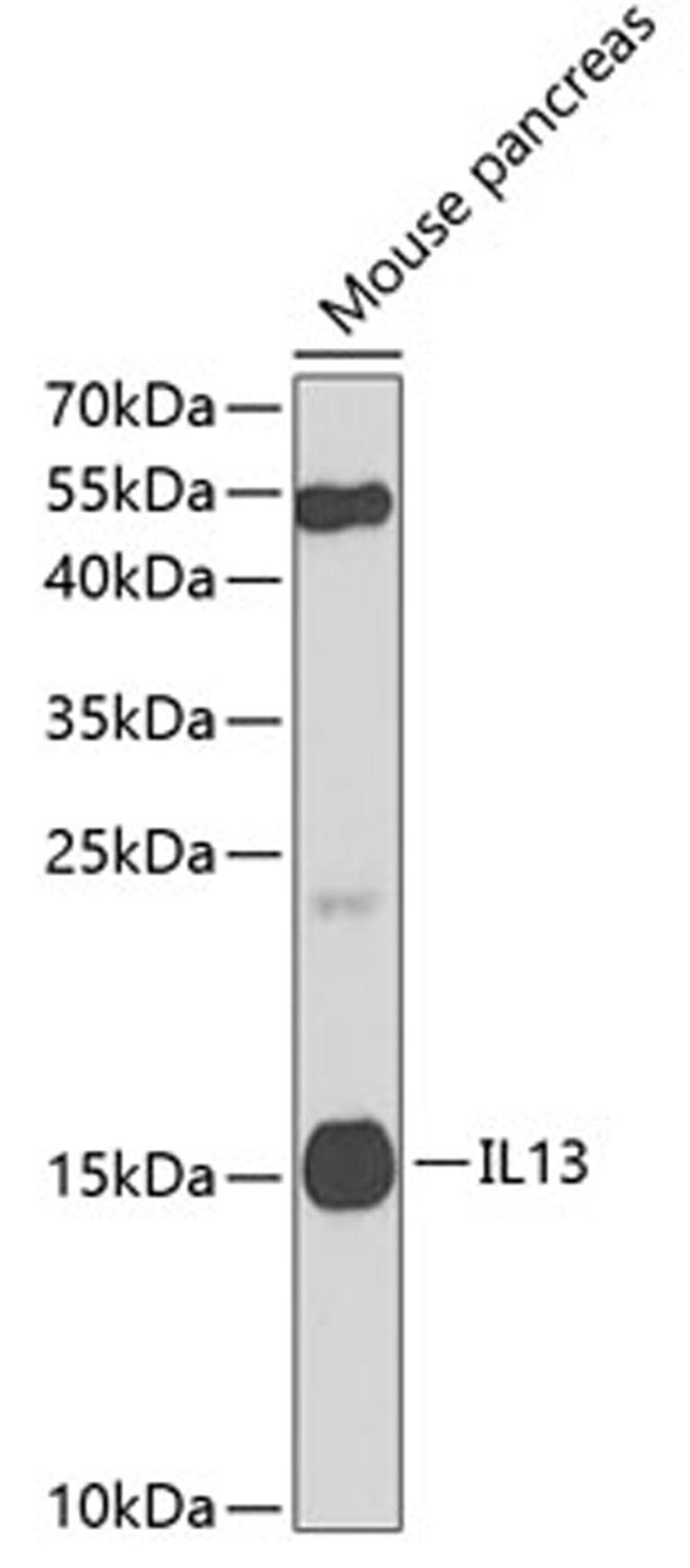 Western blot - IL13 antibody (A2089)