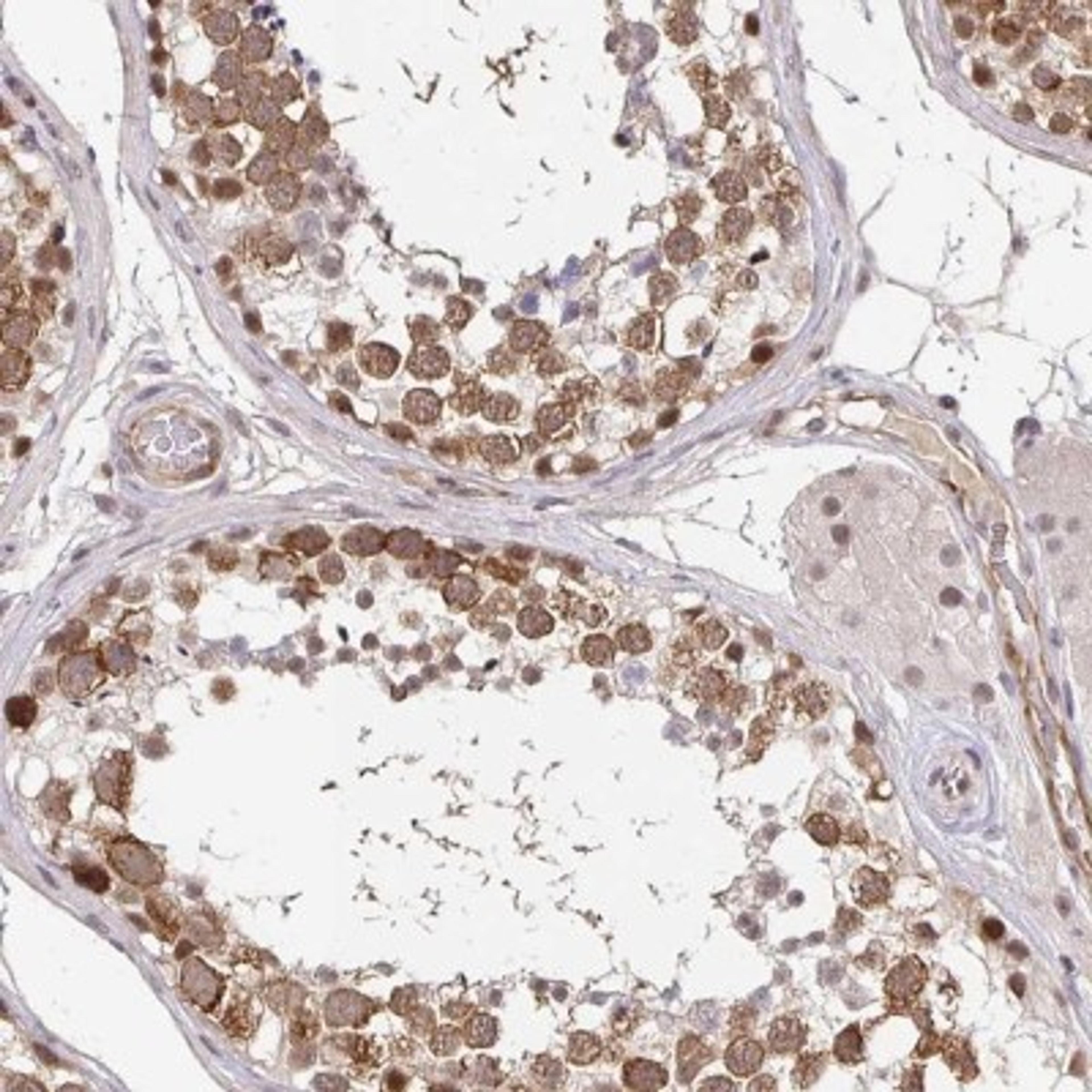 Immunohistochemistry: CLASRP Antibody [NBP2-32548] - Staining of human testis shows moderate cytoplasmic and nuclear positivity in cells in seminiferus ducts.