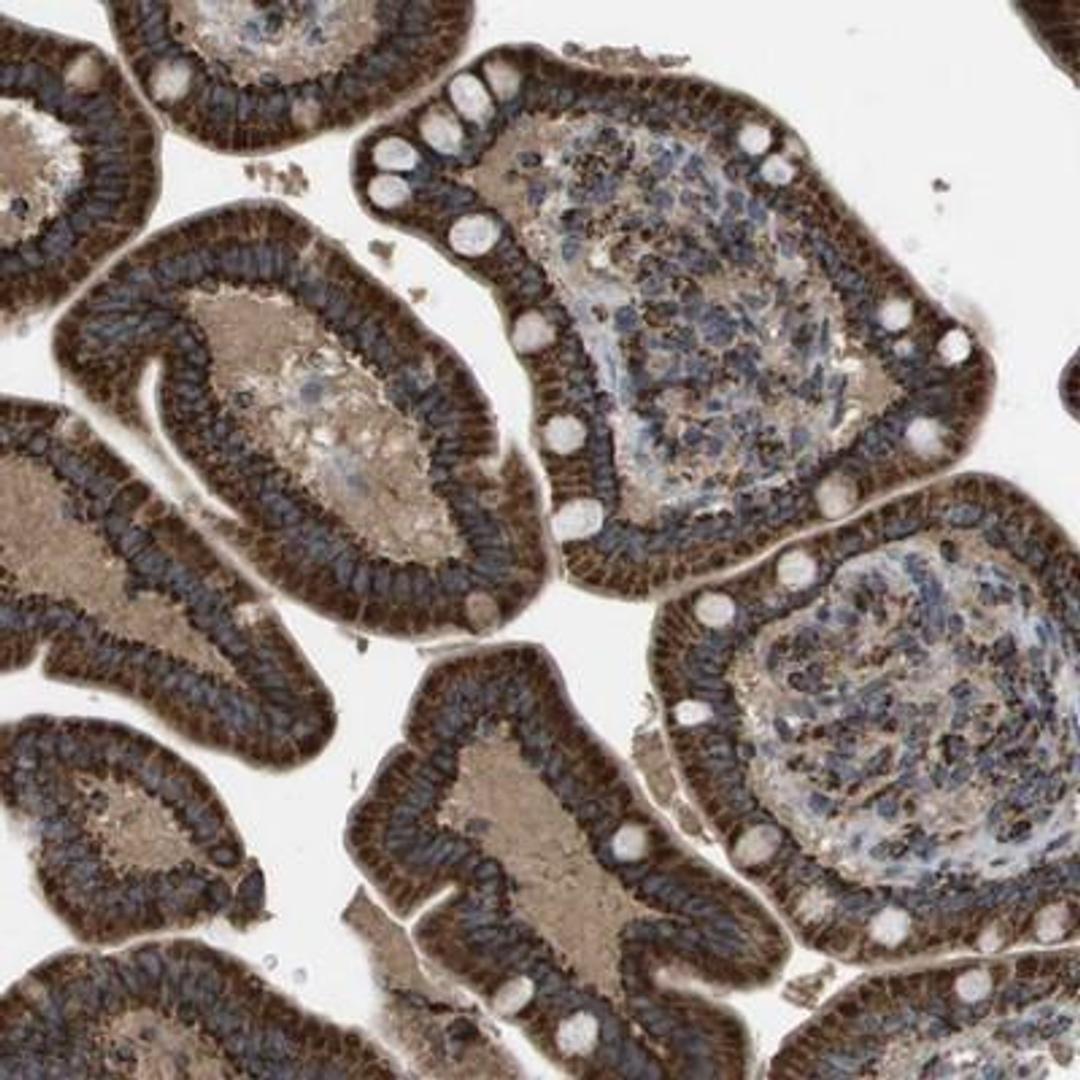 Immunohistochemistry-Paraffin: Chondrolectin Antibody [NBP1-86817] - Immunohistochemical staining of human small intestine shows strong cytoplasmic granular positivity in glandular cells.