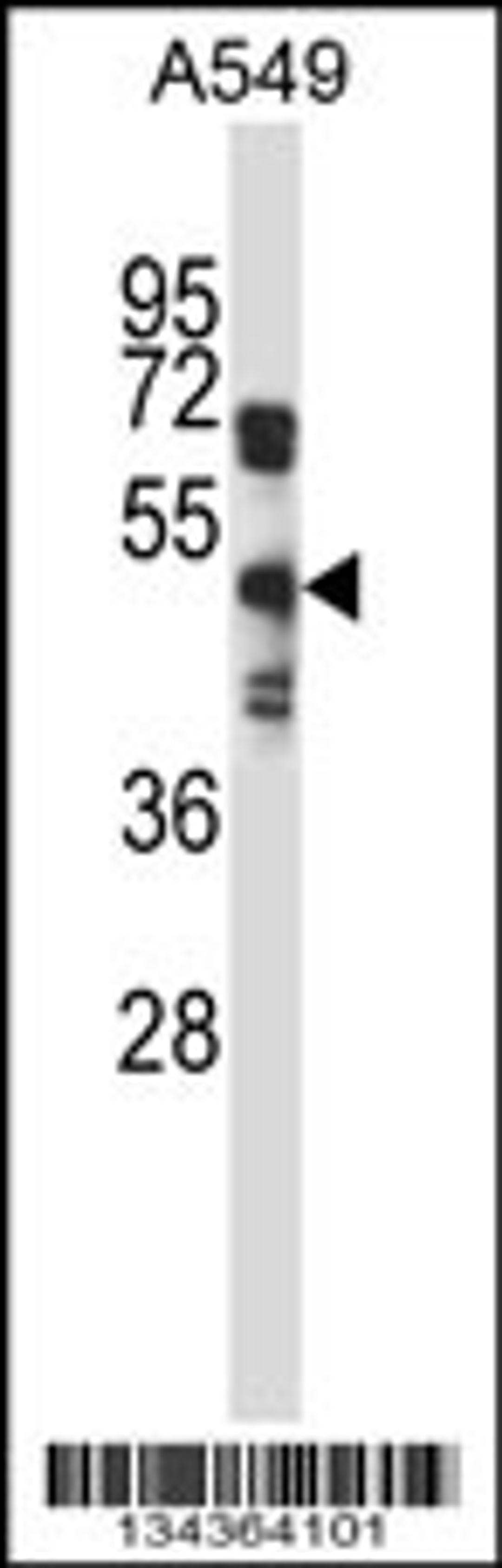 Western blot analysis in A549 cell line lysates (35ug/lane).