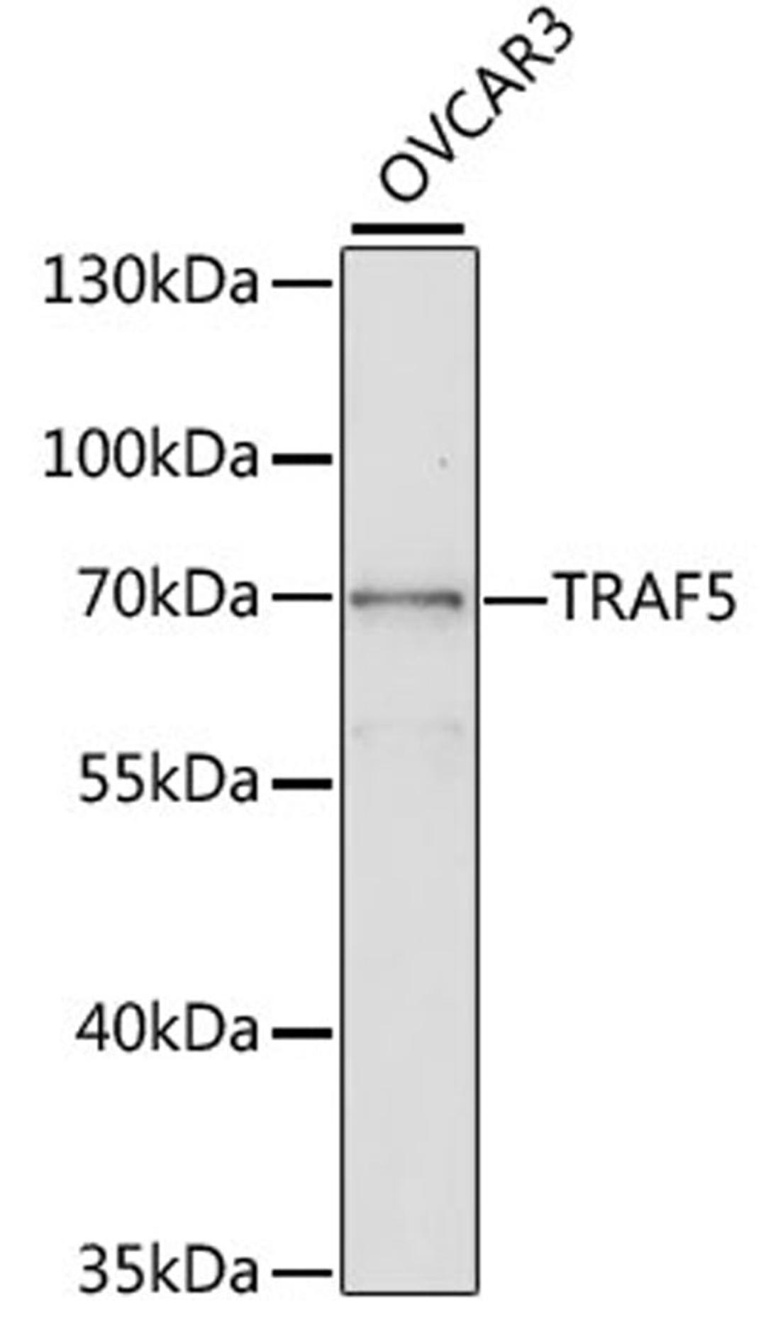 Western blot - TRAF5 antibody (A2536)