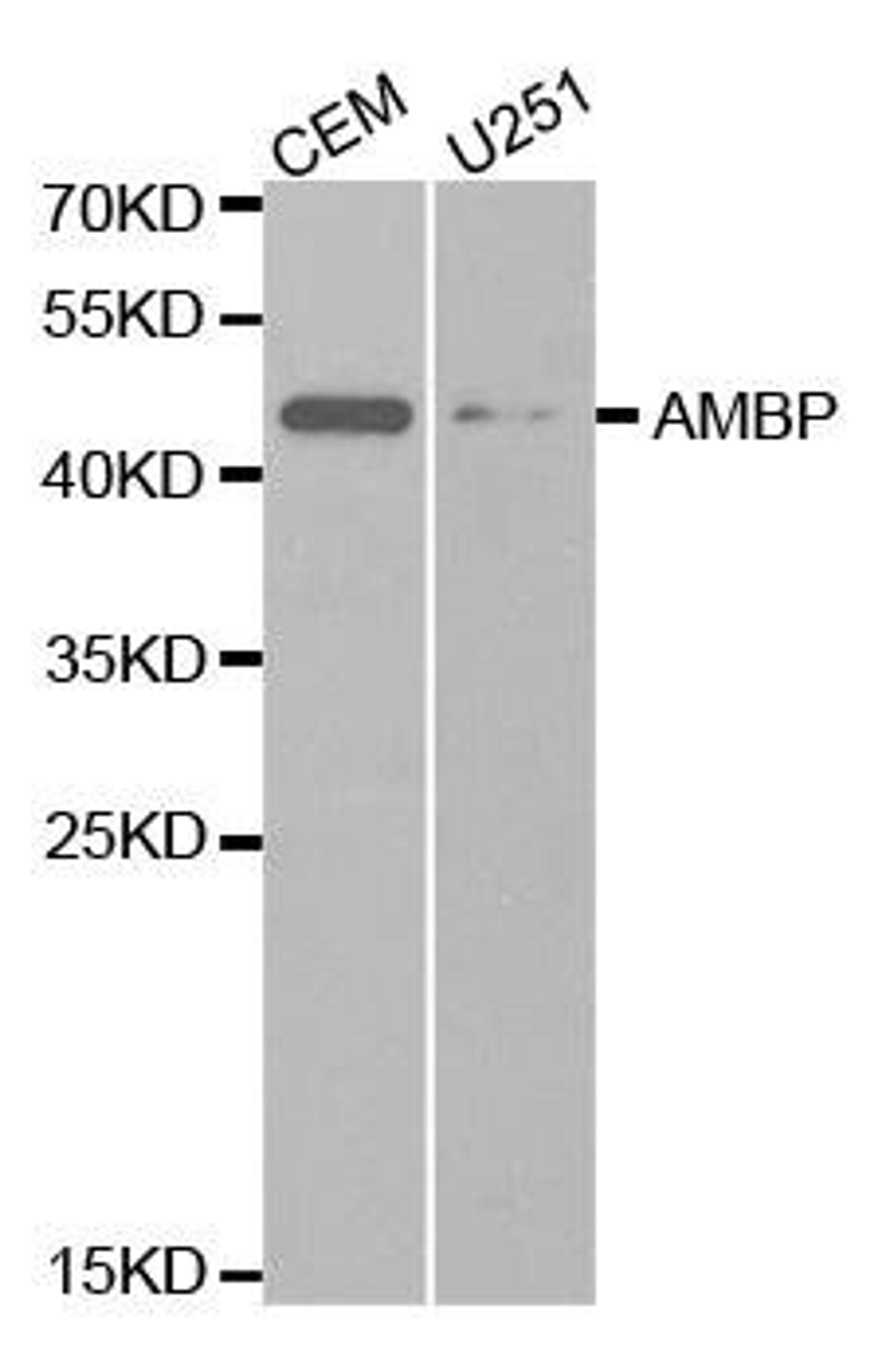 Western blot analysis of extracts of various cell lines using AMBP antibody